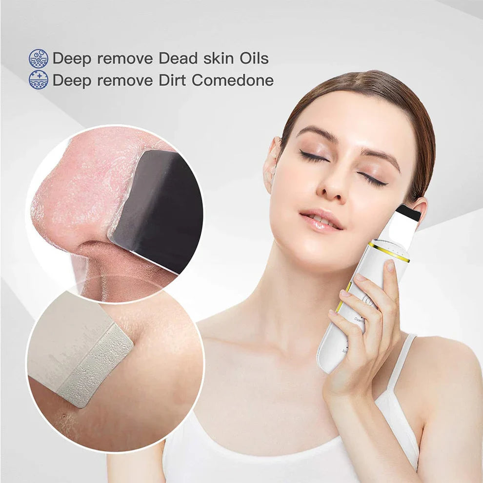 Blackhead Remover - la technologie ultrasonique nettoie en profondeur vos pores et stimule la circulation