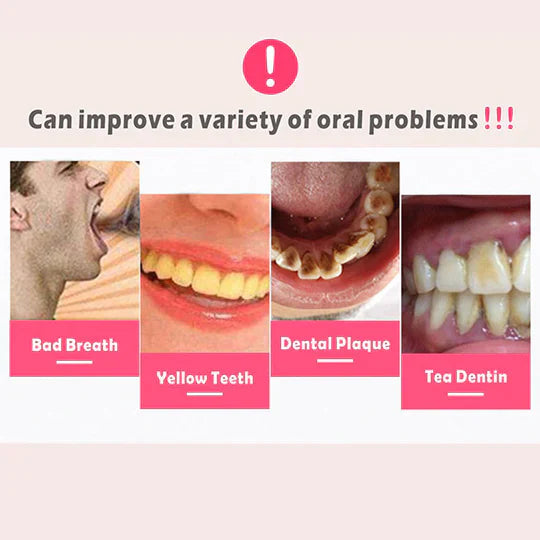 Rimozione della placca dentale