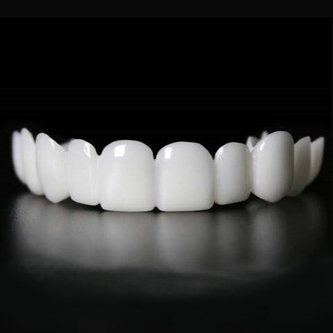 Snap on Smile Veneers (oben und unten)