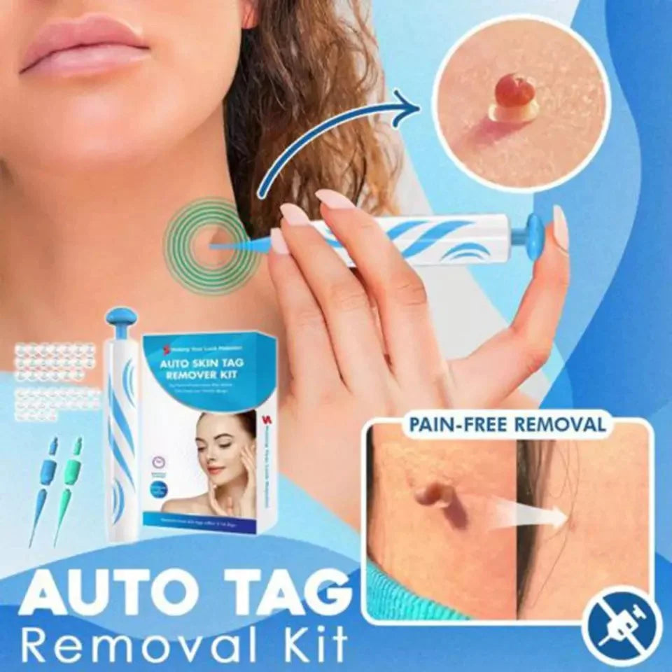 Kit de retrait de tags cutanés - enlever les tags de peau