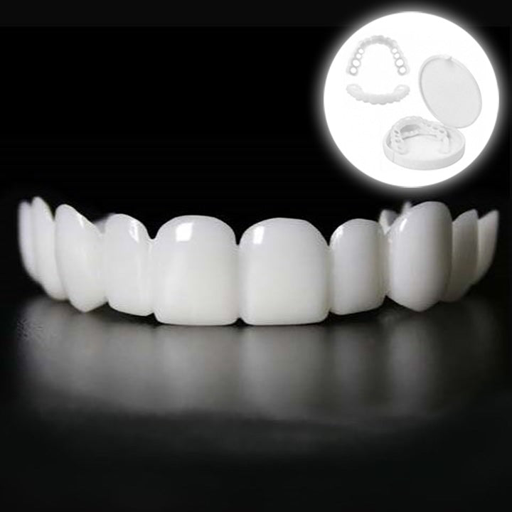 Snap on Smile Veneers (oben und unten)