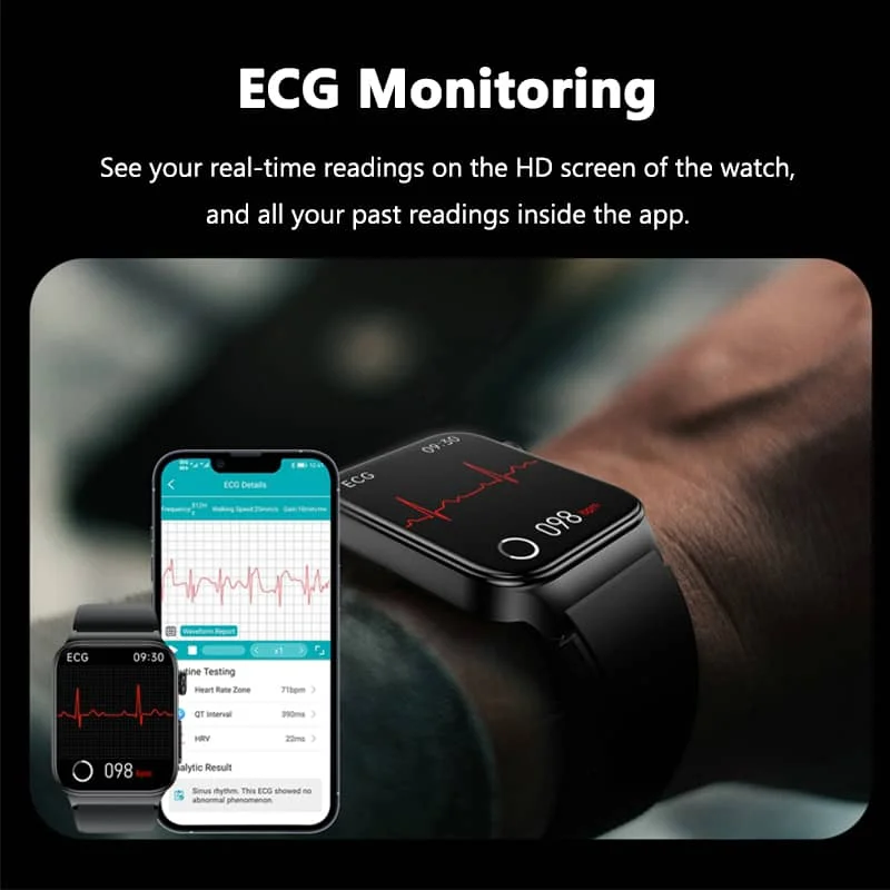 Alt-i-en sundhedsovervågnings smartwatch med EKG og blodsukker tracker