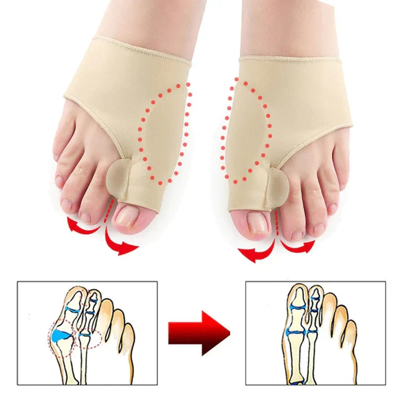 Premium Hallux Valgus Corrigerende Sok (2ST)