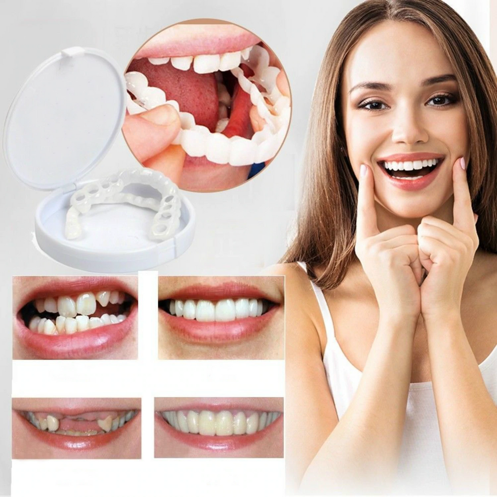 Riparazione dei denti | SEMPRE IL SORRISO PERFETTO